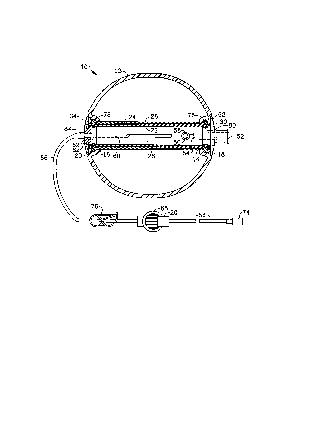 A single figure which represents the drawing illustrating the invention.